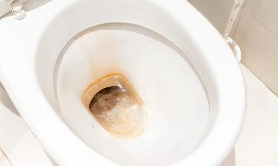 Les dangers liés à l’utilisation de l’acide chlorhydrique dans les WC