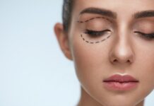 L’essentiel à connaître avant une opération de liposuccion