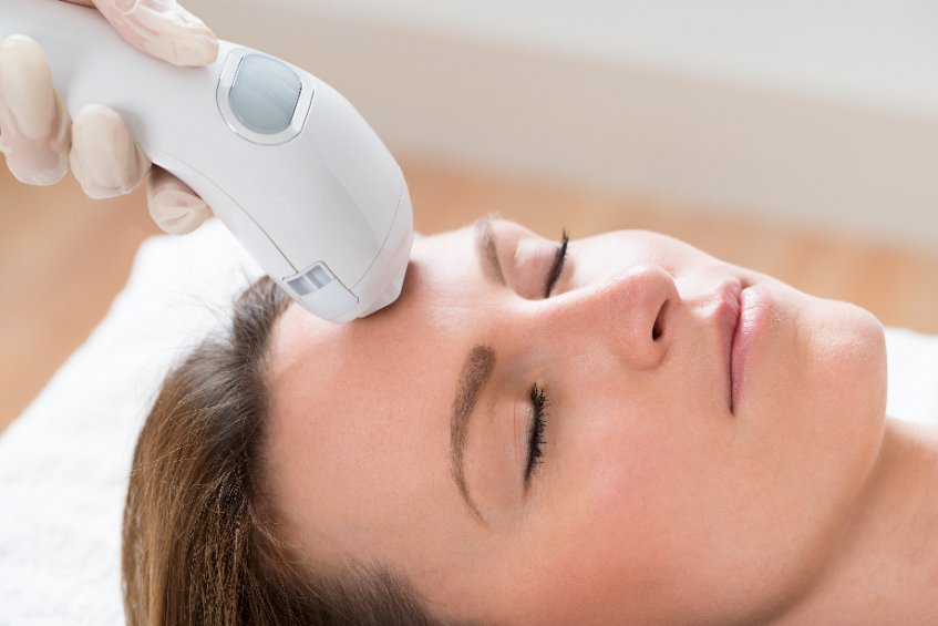 Épilation laser : quelle compatibilité selon votre type de peau ?